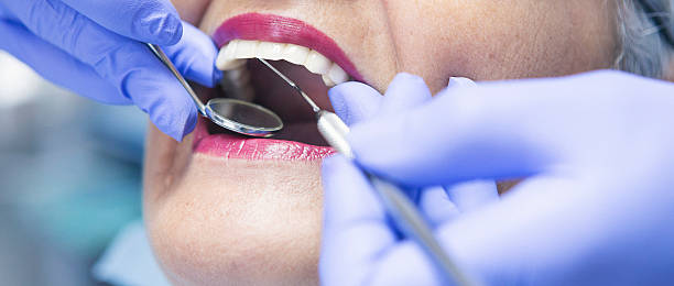 Best Dental Abscess Treatment in Alamo, GA